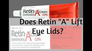 DOES RETIN quotAquot LIFT EYELIDS  Find out how  PLUS Anti Aging GIVEAWAY [upl. by Yhotmit]