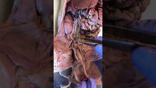 Fetal Pig Dissections 28 Female Urinary System [upl. by Orose]