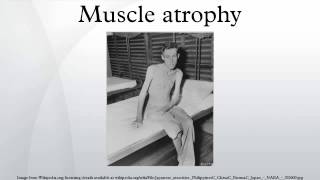 Muscle atrophy [upl. by Anekahs]