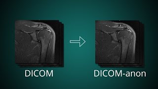 How to Anonymize DICOM images  edit DICOM tags [upl. by Euv]