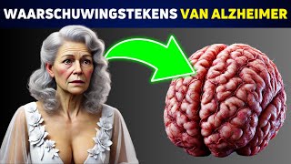 SCHOKKEND Deze 5 Gewoonten Zijn Verbonden met Alzheimer [upl. by Ellevehc]