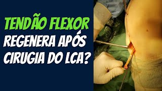 O tendão que foi retirado para enxerto se regenera FISIO EM MOVIMENTO [upl. by Yroger]