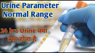 24 hour urine sample collection I 24 hrs urine [upl. by Nahij430]