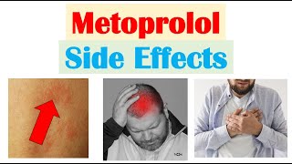 Metoprolol amp Beta Blockers Side Effects amp Why They Occur [upl. by Hseham]