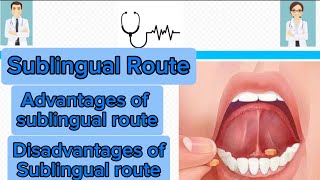 Sublingual route of drug administration  advantages and disadvantages of sublingual route [upl. by Reede]