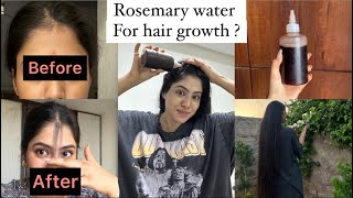 Best Lost hair regrowth remedy 😱 visible results with proof [upl. by Anircam]