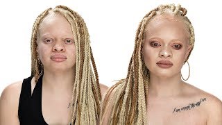 MAKEUP TUTORIAL FOR WOMEN WITH ALBINISM ft fenty beauty profilter foundation [upl. by Piotr]