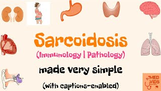 Sarcoidosis  Pathology  Immunology  Med Vids made simple [upl. by Cutcheon]