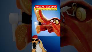 KETIKA TELINGA Berdengung permanen physics sains education science earbuds zackdfilms [upl. by Ennaeel646]