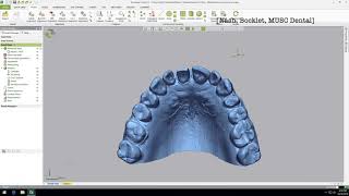 Dental Application of Geomagic Control X [upl. by Shaver193]