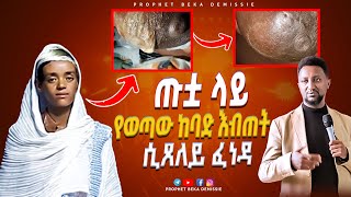 Amazing Instant Healing prophet Beka Demisieነብይ ቤካ [upl. by Eidnar]