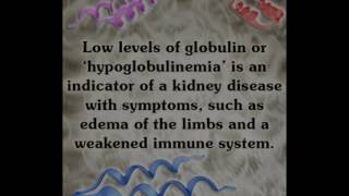 Important Information About Low Globulin All Must Be Aware Of [upl. by Arramas]