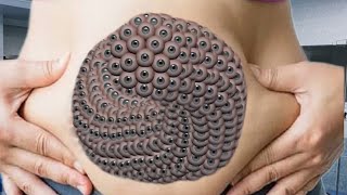 ASMR animation trypophobia maybe cleaning Bland leg foot remove ASMR dokthir onille [upl. by Arehsat]