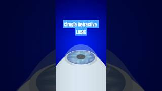 Everything you need to now about LASIK Refractive Surgery lasik lasiklaser medicaltourism [upl. by Ashjian]