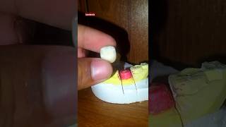 Singel ceramics cap shortvideo dental teeth satisfying [upl. by Merill]