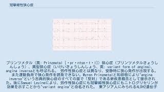 冠攣縮性狭心症 [upl. by Nobe]