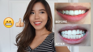 AT HOME TEETH WHITENING THAT 100 WORKS [upl. by Stillmann]