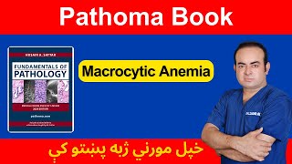 Macrocytic Anemia  Pathoma Book  Pathology [upl. by Repotsirhc193]