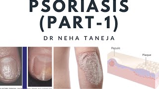 Papulosquamous disorders and PsoriasisPart1 [upl. by Haymes854]