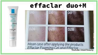 effaclar duo M 2024 منتج رائع ضد حب الشباب و اثاره و لكن ضروري من الاستعمال الصحيح [upl. by Nordin]