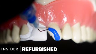 How Damaged Teeth Are Professionally Restored  Refurbished  Insider [upl. by Tiffany]