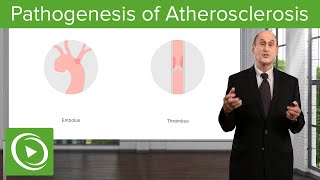 Pathogenesis of Atherosclerosis – Vascular Medicine  Lecturio [upl. by Pansie]