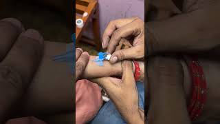 IV Cannulation  Intravenous Cannulation  Cannula kese lagate hain  cannula subscribe [upl. by Eiroj147]