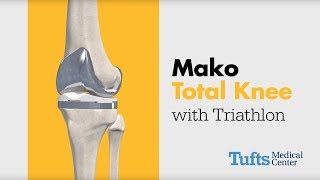 Total Knee Replacement Animation  Tufts Medical Center [upl. by Brenna]