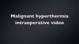 Malignant Hyperthermia Intraoperative video  Case Report [upl. by Spiro51]