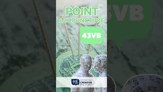 POINT D’ACUPUNCTURE  43VB  Xia Xi acupuncture acupuncturepoints medecinechinoise [upl. by Favianus303]