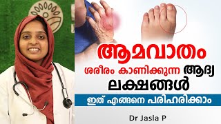 ആമവാതം ശരീരം കാണിക്കുന്ന ആദ്യ ലക്ഷങ്ങൾ  Amavatham treatment  Dr Jasla P [upl. by Wyatan]