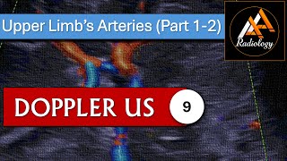 9  Upper Limbs Arteries Part 12 [upl. by Ardnaik]