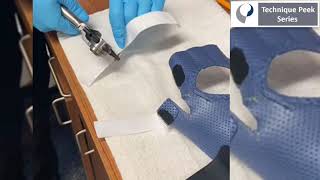 How to Create a Radial Nerve Palsy Splint  Technique Peek Series [upl. by Dearborn]