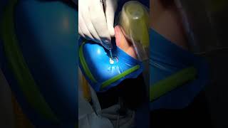 ¡Recupera tu diente con endodoncia 🦷✨ Elimina infecciones y restaura su función 🌟 [upl. by Staffan175]