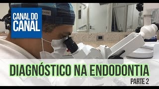 Video 2  Diagnóstico na Endodontia  Parte 2 [upl. by Onaicilef]