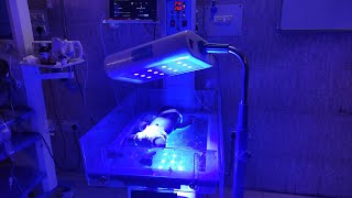 Phototherapy Treatment For Jaundice  Phototherapy In Newborn [upl. by Washko768]