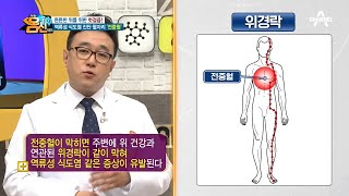 위 건강 위한 혈자리 지압법 전중혈로 역류성 식도염을 진단할 수 있다  나는 몸신이다 261 회 [upl. by Nosidam]