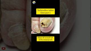 Terbinafine tablet Uses part 1 [upl. by Onfroi]