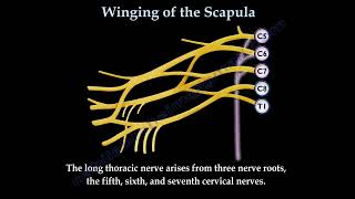 WINGING OF THE SCAPULALONG THORACIC NERVE  Everything You Need To Know  Dr Nabil Ebraheim [upl. by Alexis]