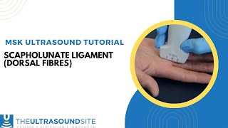 Ultrasound of the dorsal fibres of the Scapholunate ligament [upl. by Sabina]