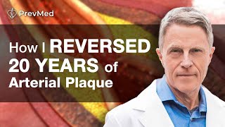 How I Reversed 20 years of Arterial Plaque [upl. by Epilif]