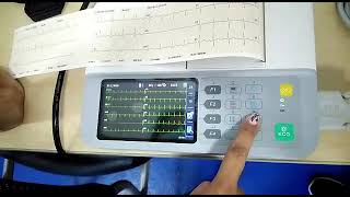 electrocardiografo mindray beneheart R3 [upl. by Towney170]