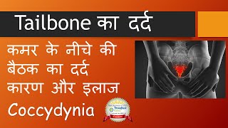 Tailbone का दर्द  कारण और इलाज । कमर के नीचे की बैठक का दर्द Causes amp Treatment  Coccydynia [upl. by Aiselad]