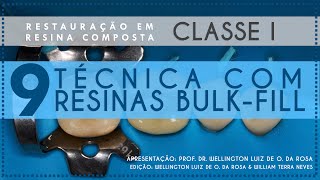 9 Técnica com Bulk Fill [upl. by Synned]