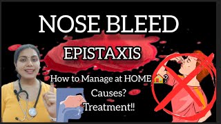 EPISTAXIS🩸 NOSE BLEED नकसीर How to Manage at HOME 🏠 Causes Treatment In details epistaxis [upl. by Hsihsa]