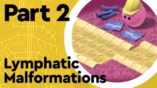 What are Lymphatic Malformations Lymphatic System Part 2 [upl. by Brianna643]