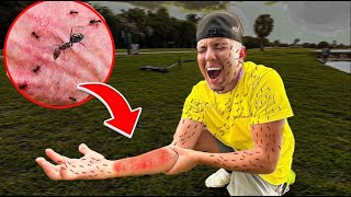 I Got ATTACKED By KILLER ANTS LIVE [upl. by Yetty449]