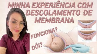 DESCOLAMENTO DE MEMBRANA MINHA EXPERIÊNCIA [upl. by Aray]