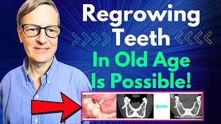 Regrowing Teeth In Old Age Is Possible Human Trial Starts This Year [upl. by Lorenzo]