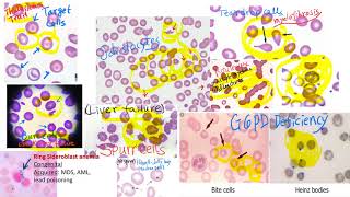 hematology in 10 min Peripheral blood smear examination under microscope [upl. by Grier]